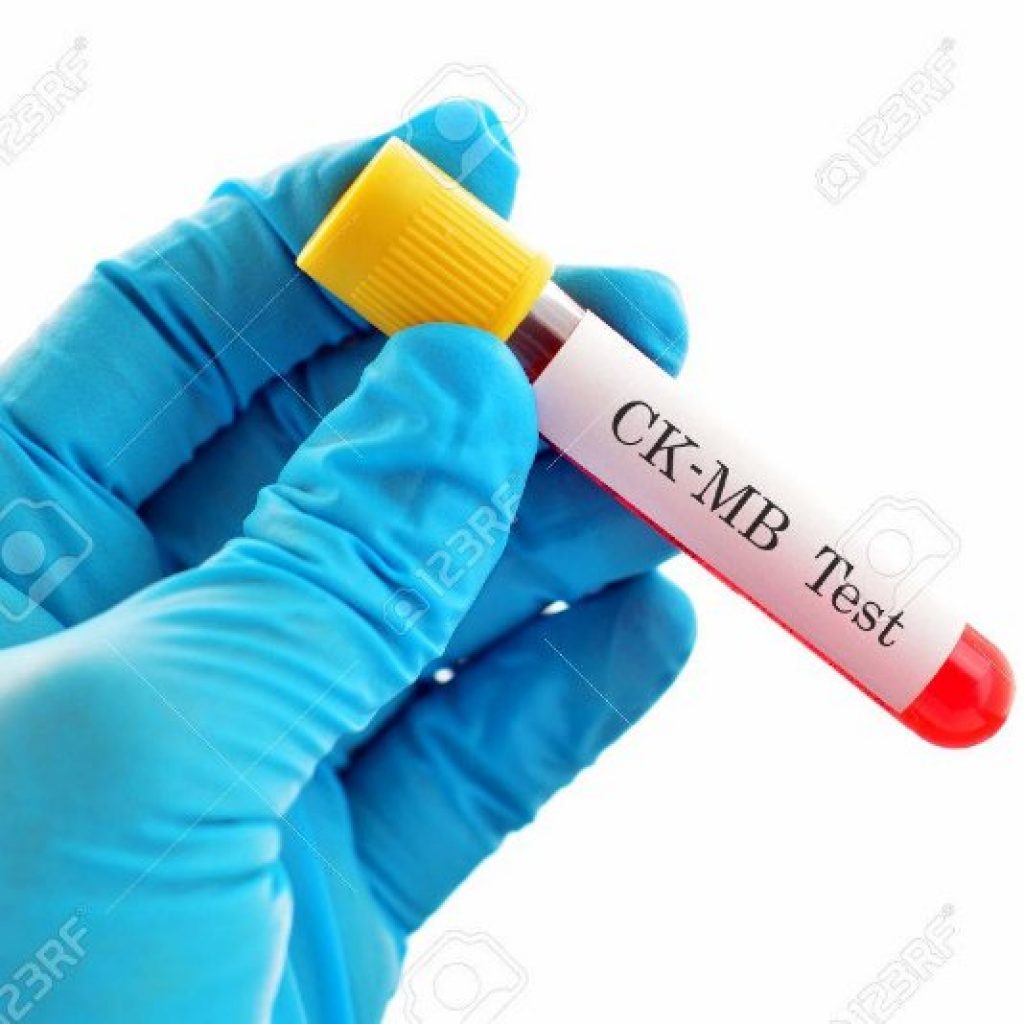 Xét nghiệm CK là gì và những điều cần biết? Xét nghiệm Dr.Labo