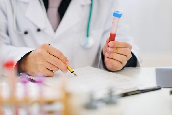 Xét nghiệm máu tổng quát